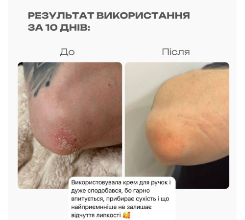Крем для рук гідроінтенсивний Gemely з сечовиною, вишневий лікер, 75 мл