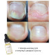 DARK Oil onycholysis oil, 3 ml