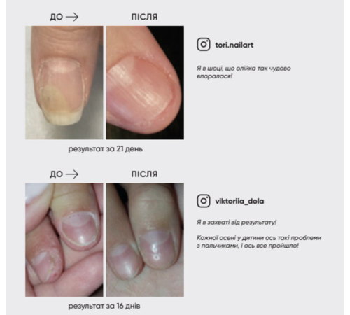 Oil from onycholysis NAILSOFTHEDAY OniStop, 15 ml