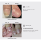 Oil from onycholysis NAILSOFTHEDAY OniStop, 15 ml