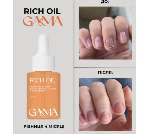 GaMa Rich Oil nourishing oil with squalene for nail treatment, against onycholysis, 2.5 ml