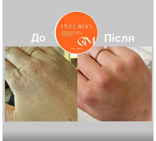GaMa Peeling Peel hand peeling roller