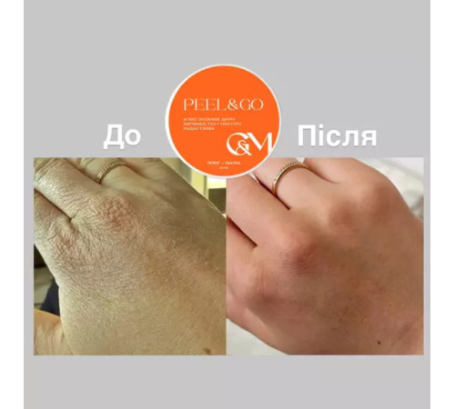 GaMa Peeling Peel hand peeling roller